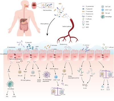 The oral-gut microbiome axis in inflammatory bowel disease: from inside to insight